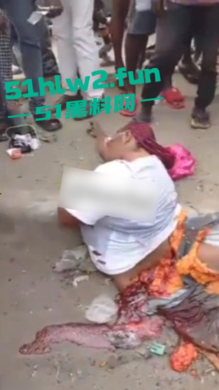 【血腥恐怖】尼日利亚重大车祸一妇女坐在货车前休息，由于视线盲区司机并未发现 将其碾压成两截。-4